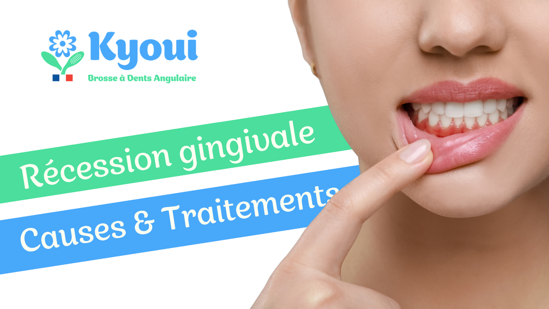 Gencives qui se rétractent : causes, prévention et meilleures solutions pour protéger votre sourire