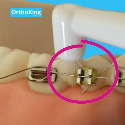 Brossette Electrique Sonique Orthoking